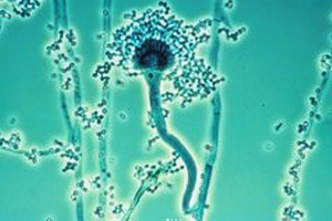 ΜΥΚΟΤΟΞΙΝΕΣ ΣΤΟΥΣ ΣΠΟΡΟΥΣ